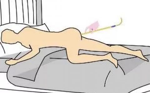 姜湯灌腸、姜粉泥灌腸、姜粉灌腸步驟(2020年更新版)-七不姜 生姜養生網-明德CSA生態姜園&明安農業