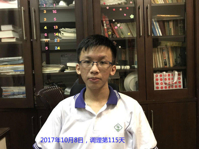 原始点调理严重湿疹:找回帅气的自己 原始点调理严重湿疹:找回帅气的自己