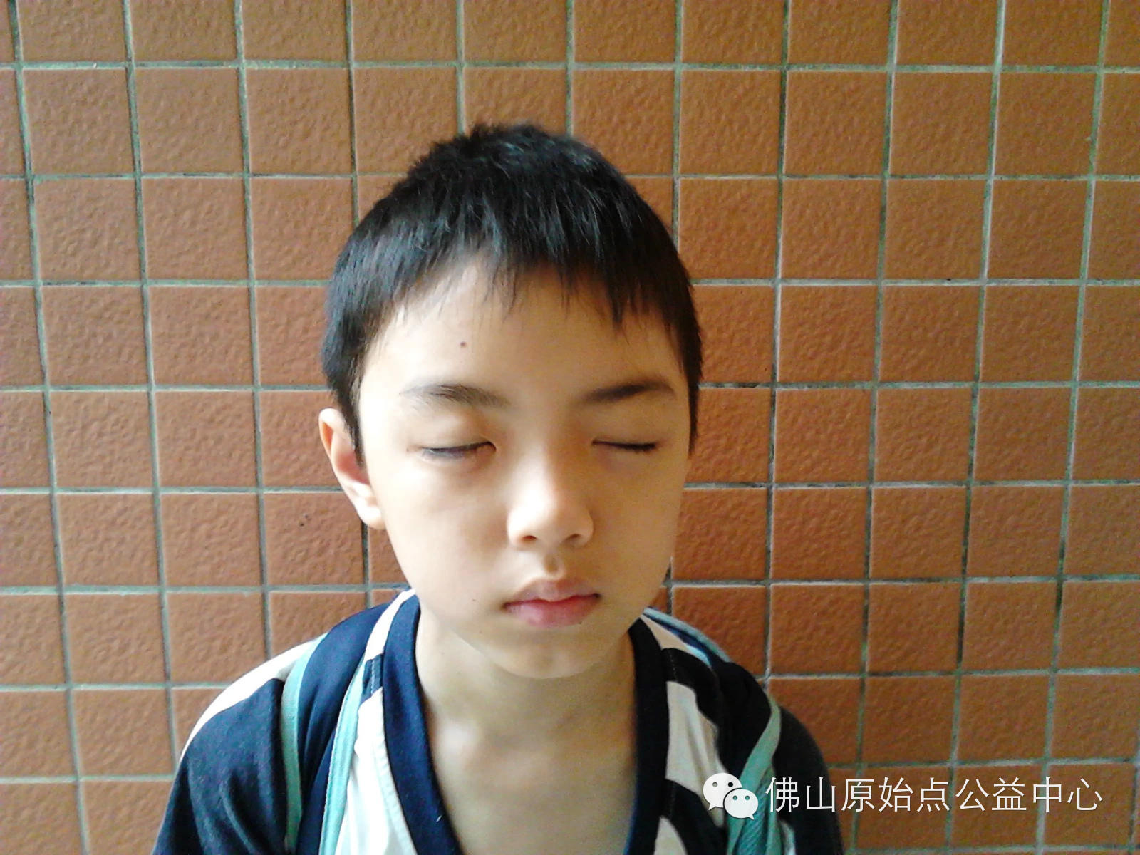 用原始点理疗病毒性脑炎后遗症三个月好了一大半