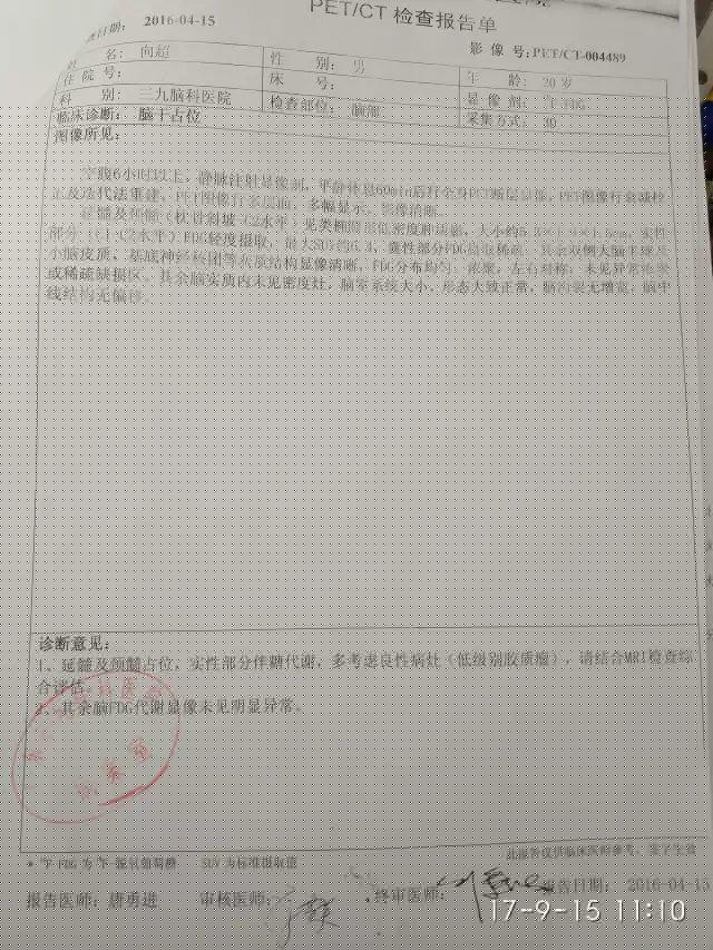 原始点调理脑胶质瘤：告别风雨见阳光