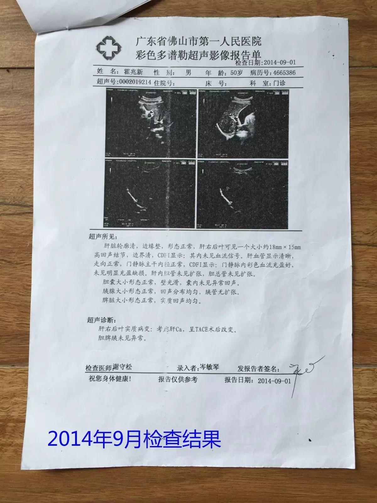 原始点调理肝癌三年后回访录：霍兆新