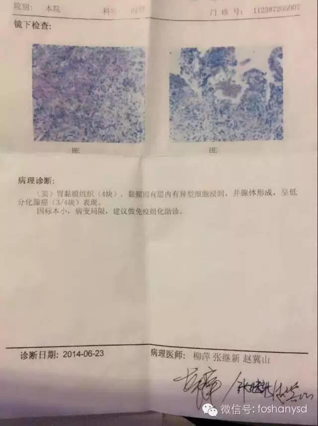 北京原始点中心案例 | 丛女士自述胃癌案例