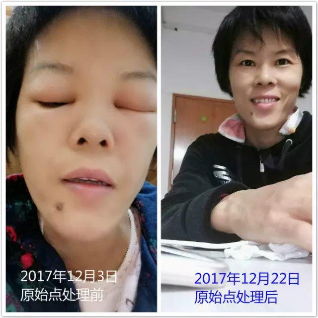 原始点调理附子中毒:细节决定成败 原始点调理附子中毒:细节决定成败