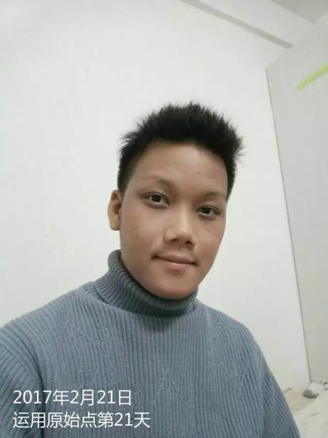 原始点调理23年严重湿疹:《21天的震撼》 原始点调理23年严重湿疹:《21天的震撼》