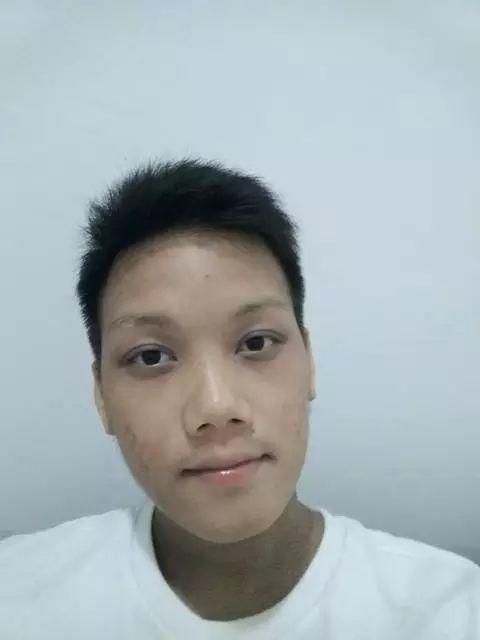 原始点调理23年严重湿疹:《21天的震撼》 原始点调理23年严重湿疹:《21天的震撼》