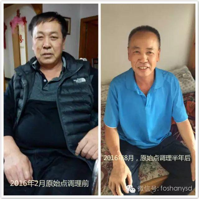 触目惊心  原始点调理八年病史牛皮癣，半年基本恢复健康