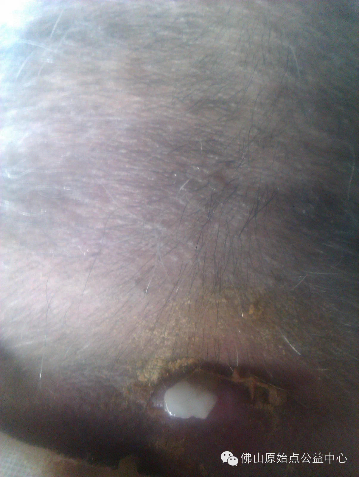 十几年对口疮  原始点调理27天康复