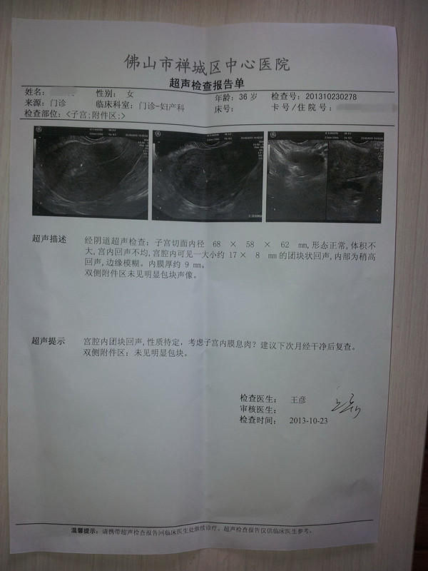 原始点成功助排子宫终止妊娠胎儿 原始点成功助排子宫终止妊娠胎儿