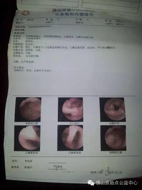 中晚期结肠癌八个月原始点理疗基本康复