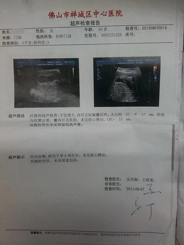 原始点成功助排子宫终止妊娠胎儿 原始点成功助排子宫终止妊娠胎儿