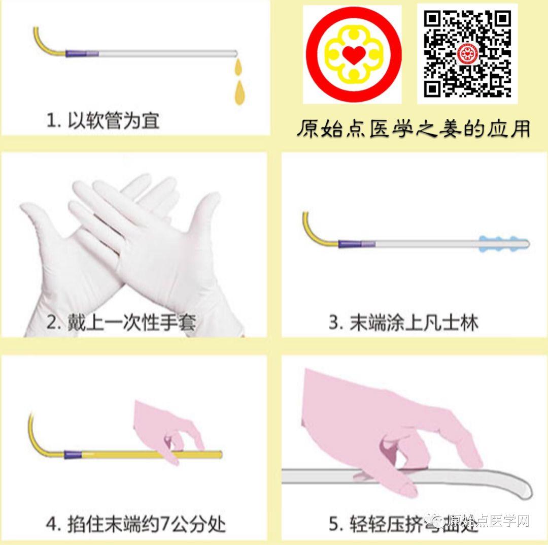 精华汇总 | 原始点医学之姜的应用(新增灌肠部分)201808第13版 精华汇总 | 原始点医学之姜的应用(新增灌肠部分)201808第13版