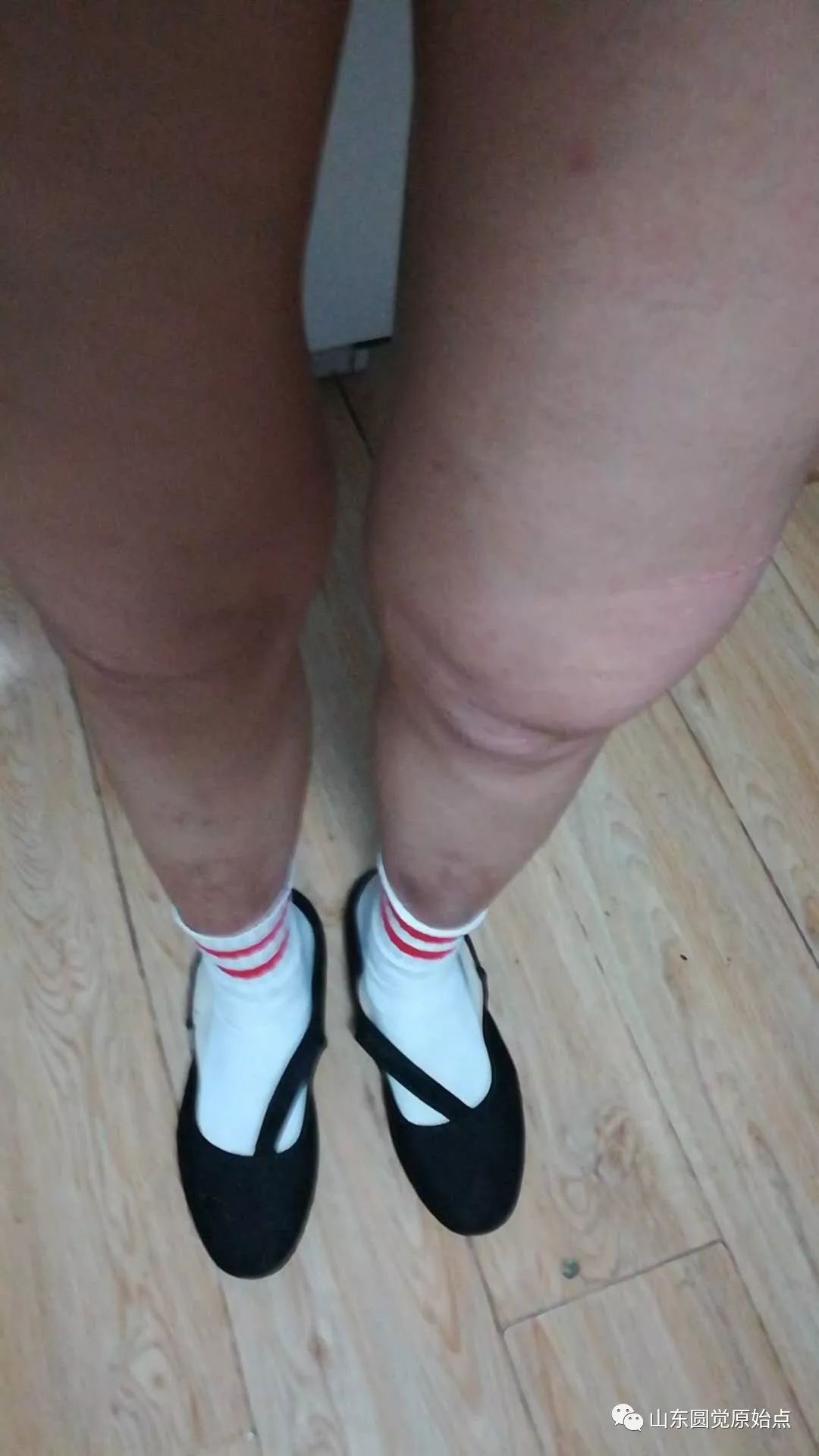 原始点案例:膝盖肿胀 原始点案例:膝盖肿胀