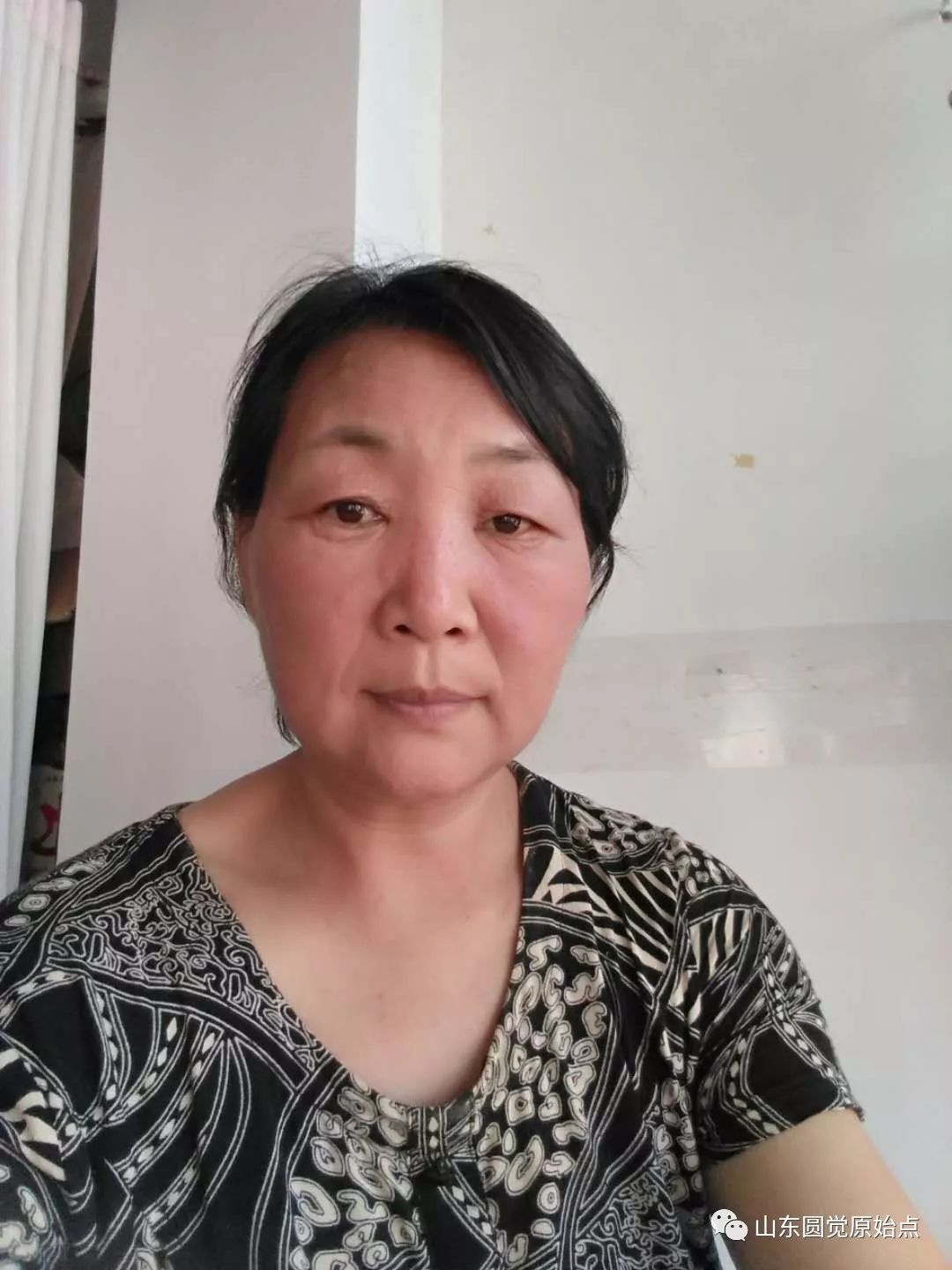 山东原始点案例:化妆品过敏脸部浮肿 山东原始点案例:化妆品过敏脸部浮肿