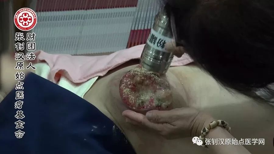 乳癌处理注意事项 乳癌处理注意事项