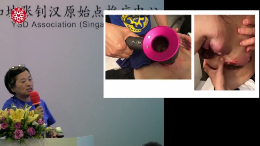 乳癌肿瘤处理 乳癌肿瘤处理