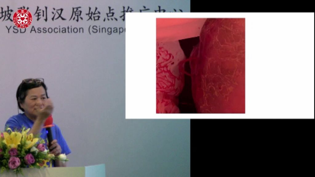 乳癌肿瘤处理 乳癌肿瘤处理