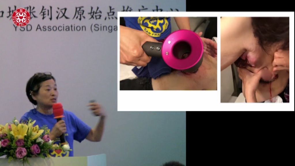 乳癌肿瘤处理 乳癌肿瘤处理