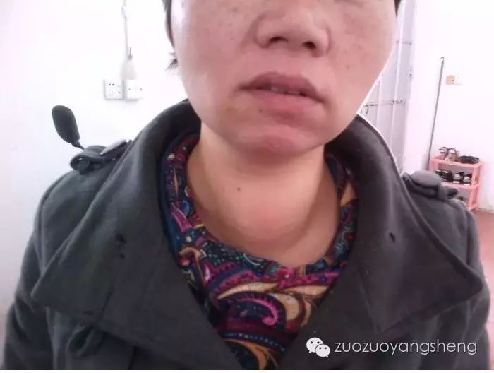 案例分享:两个癌肿瘤案例成败对比,背后的原因值得深思 案例分享:两个癌肿瘤案例成败对比,背后的原因值得深思