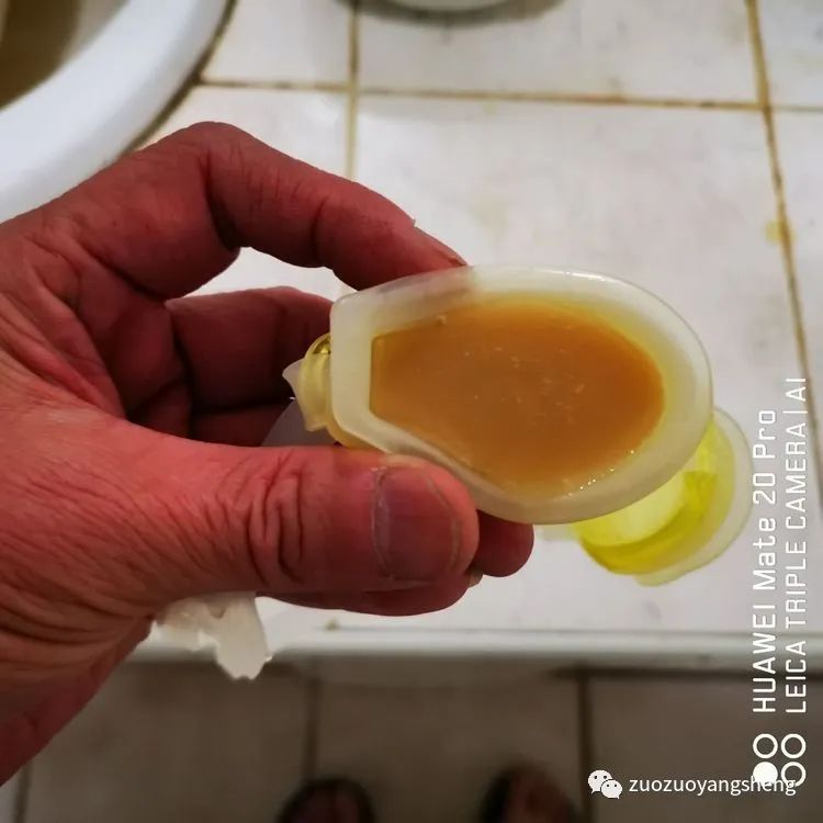 案例分享：原始点调理视力下降、视物模糊的案例