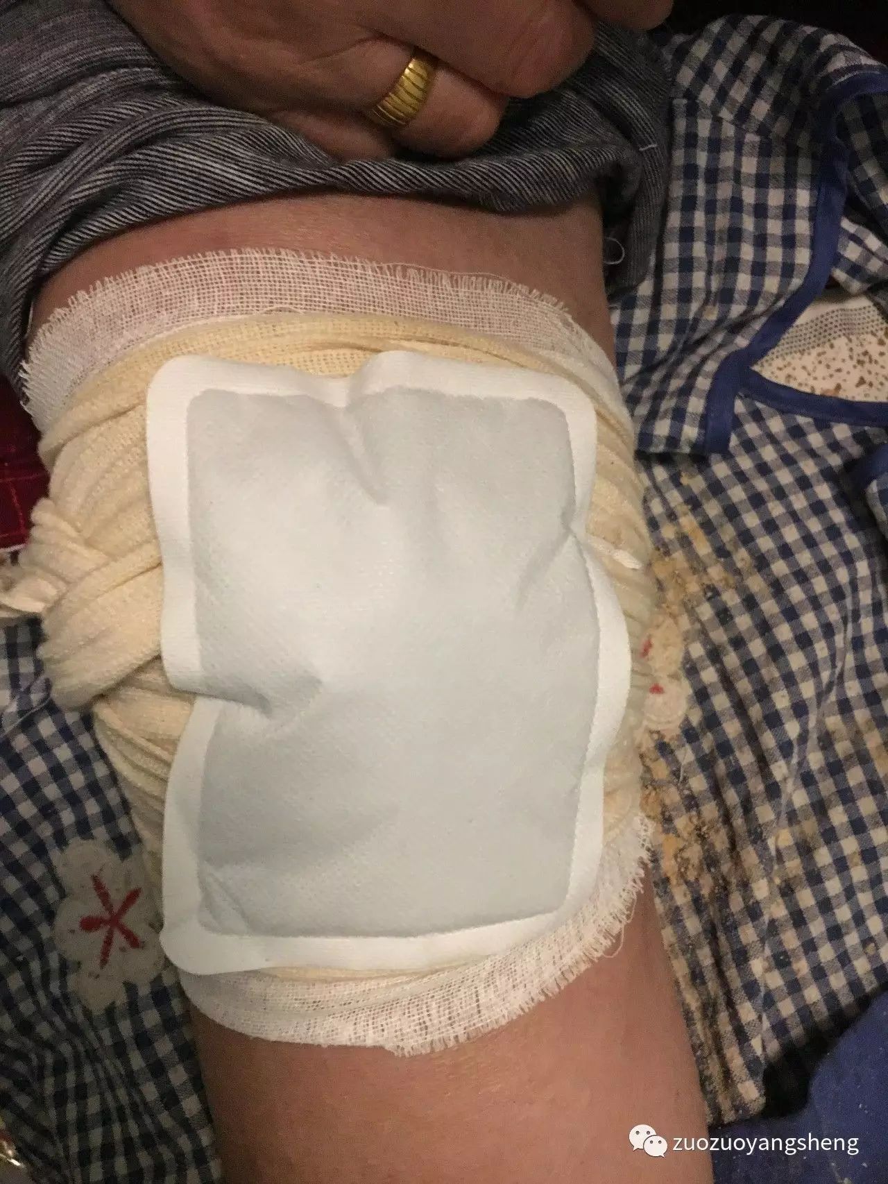 案例分享:最难度的家人——原始点调理妈妈骨折手术后的康复 案例分享:最难度的家人——原始点调理妈妈骨折手术后的康复