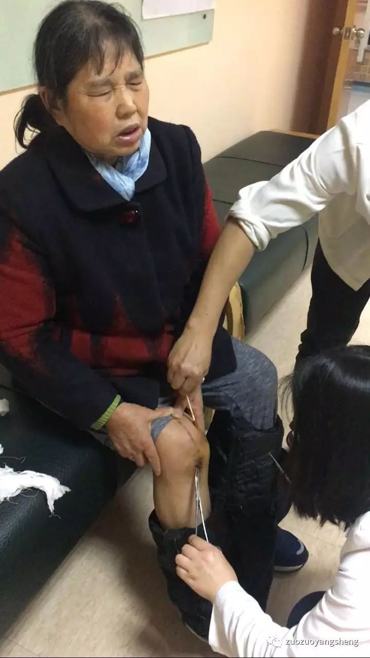 案例分享:最难度的家人——原始点调理妈妈骨折手术后的康复 案例分享:最难度的家人——原始点调理妈妈骨折手术后的康复