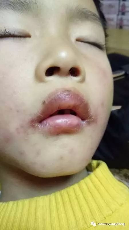 原始点调理小朋友过程中所出现的好转反应大总结 原始点调理小朋友过程中所出现的好转反应大总结