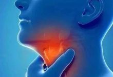 微问答137期：嗓子痛、咳嗽是喝姜汤还是板蓝根与菊花茶-原始点全球同学网