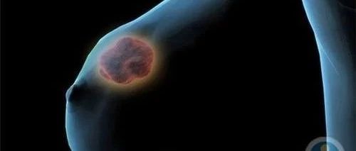 案例分享：原始点调理乳腺痛、胸痛、易疲劳案例-原始点全球同学网