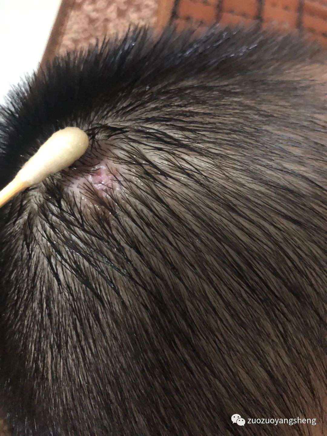 微问答184期：孩子头上肿包溃烂，网上查的资料好令人着急的……