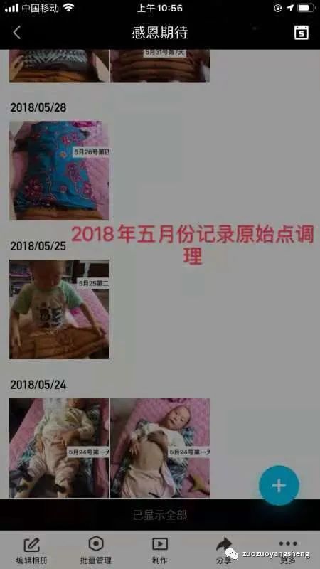 案例分享：原始点调理脑瘫患儿的案例分享