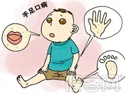 案例分享：原始点调理手足口病-原始点全球同学网