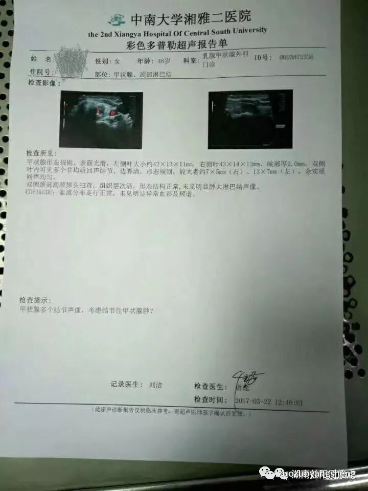 案例分享:甲状腺肿瘤,腹部有硬块皮表呈黑色案例分享 案例分享:甲状腺肿瘤,腹部有硬块皮表呈黑色案例分享