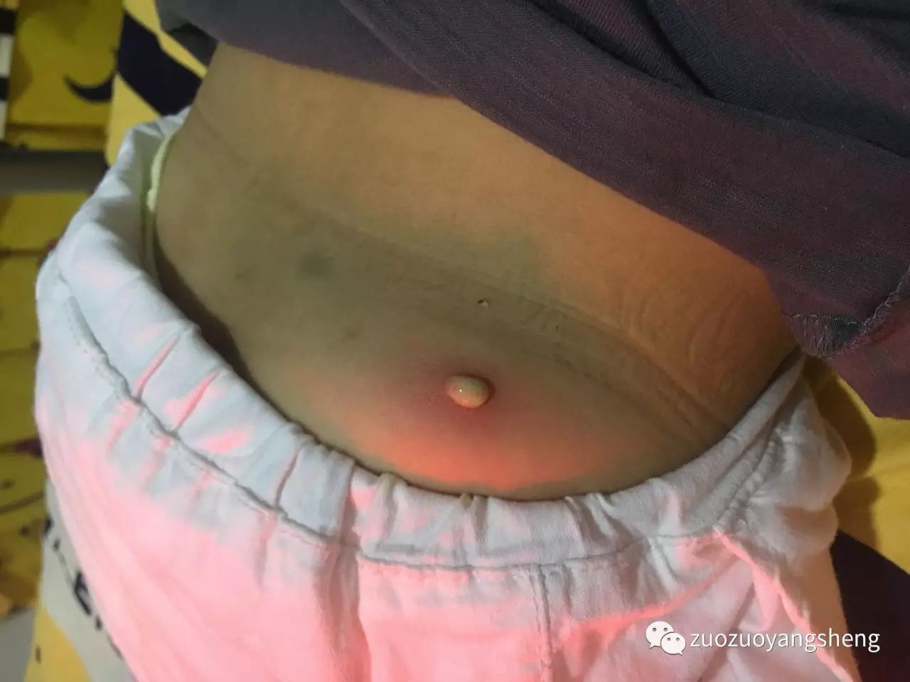 原始点调理小朋友过程中所出现的好转反应大总结 原始点调理小朋友过程中所出现的好转反应大总结