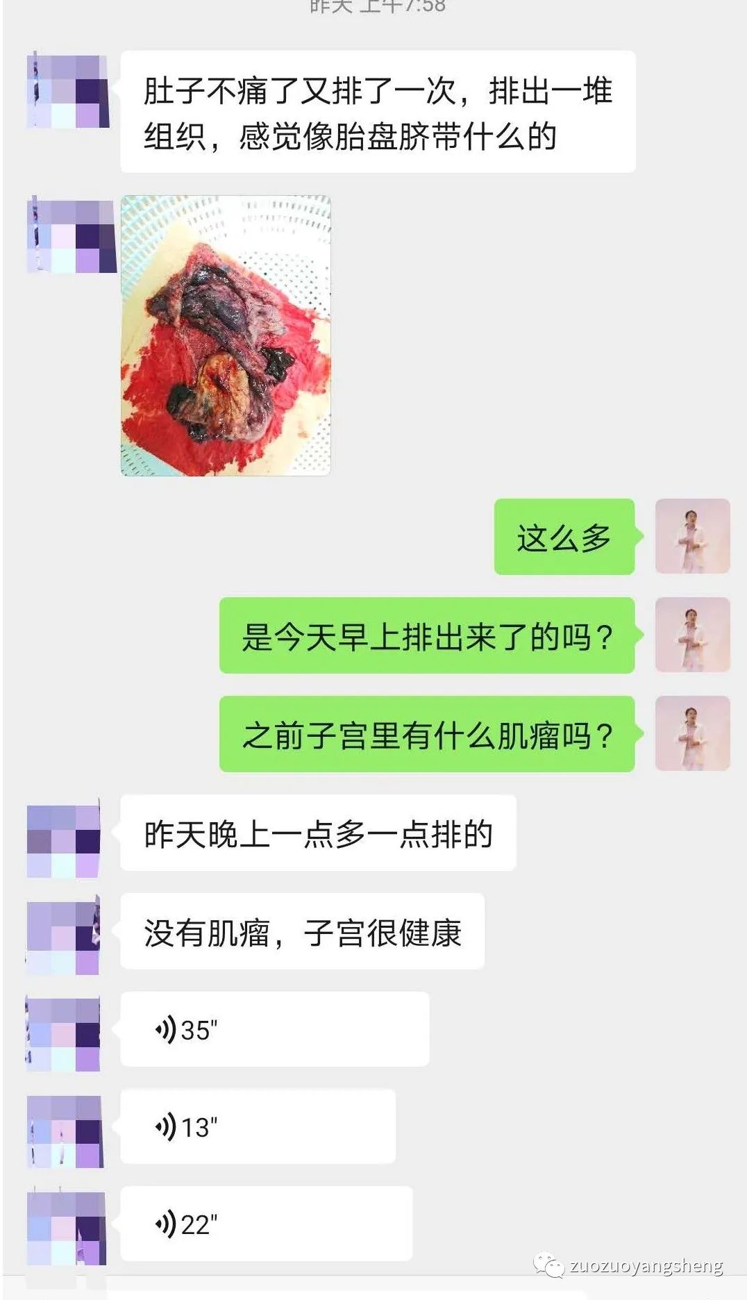 案例分享:原始点调理三天排死胎的案例。 案例分享:原始点调理三天排死胎的案例。