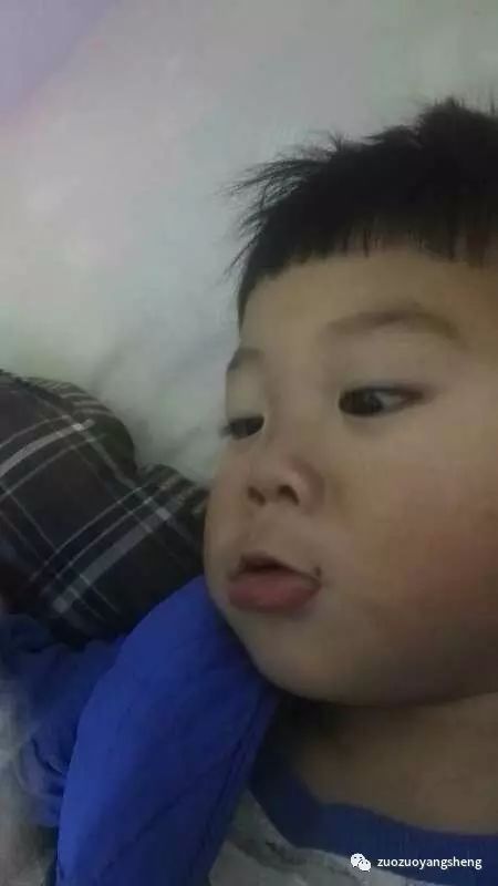 案例分享:原始点调理小朋友吃寒凉水果而嘴唇红肿的案例 案例分享:原始点调理小朋友吃寒凉水果而嘴唇红肿的案例