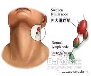淋巴癌三年了，原始点调理一段时间后，现在不坚持了怎么办？-原始点全球同学网