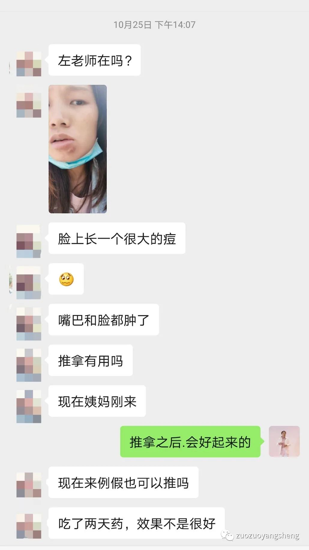 案例分享:原始点调理下巴长痘,咬肌发炎肿大的案例 案例分享:原始点调理下巴长痘,咬肌发炎肿大的案例