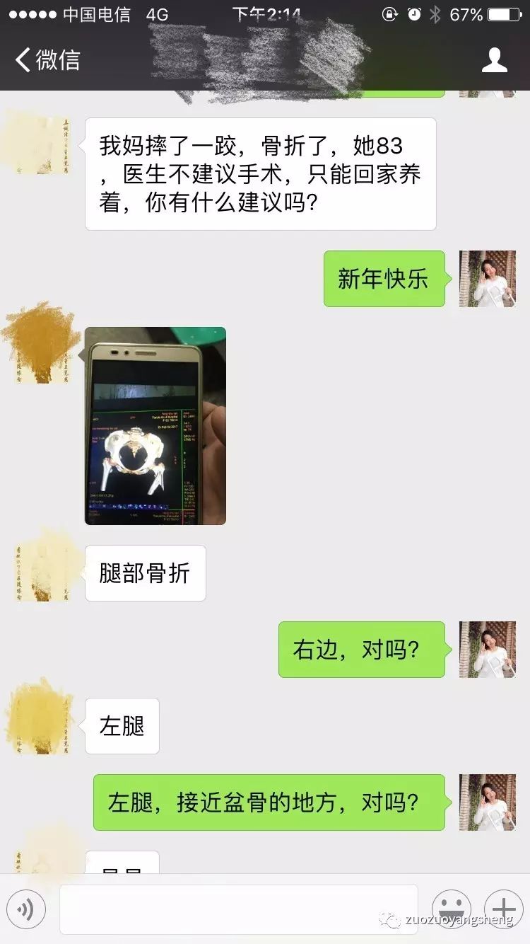 原始点续写又一奇迹:83岁婆婆骨折错位没开刀没手术,6周康复 原始点续写又一奇迹:83岁婆婆骨折错位没开刀没手术,6周康复