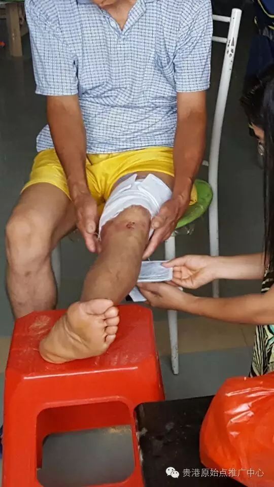 案例分享:原始点调理车祸烧伤不留疤的案例 案例分享:原始点调理车祸烧伤不留疤的案例