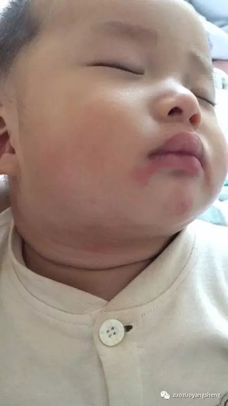 原始点调理小朋友过程中所出现的好转反应大总结 原始点调理小朋友过程中所出现的好转反应大总结