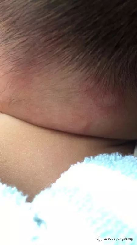 原始点调理小朋友过程中所出现的好转反应大总结 原始点调理小朋友过程中所出现的好转反应大总结