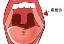 两岁孩子扁桃疑似肿大三度,习惯性感冒,怎么办?-原始点全球同学网