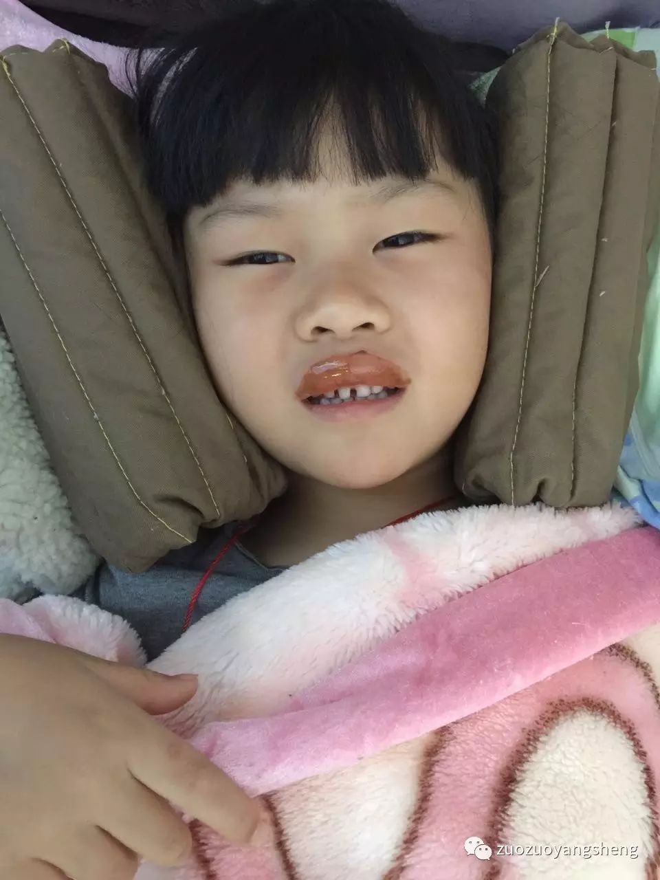 案例分享:原始点调理新年“食物中毒”的案例 案例分享:原始点调理新年“食物中毒”的案例