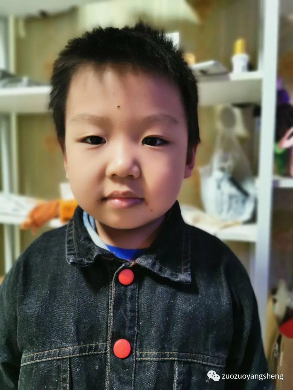 案例分享:原始点调理儿童手足口病的案例 案例分享:原始点调理儿童手足口病的案例