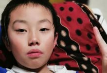 案例分享:原始点调理儿童淋巴结肿大,腺样体肥大,张嘴呼吸的案例-原始点全球同学网