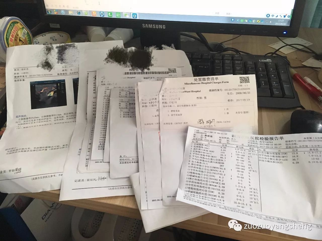 案例分享：原始点调理儿子的腮腺炎