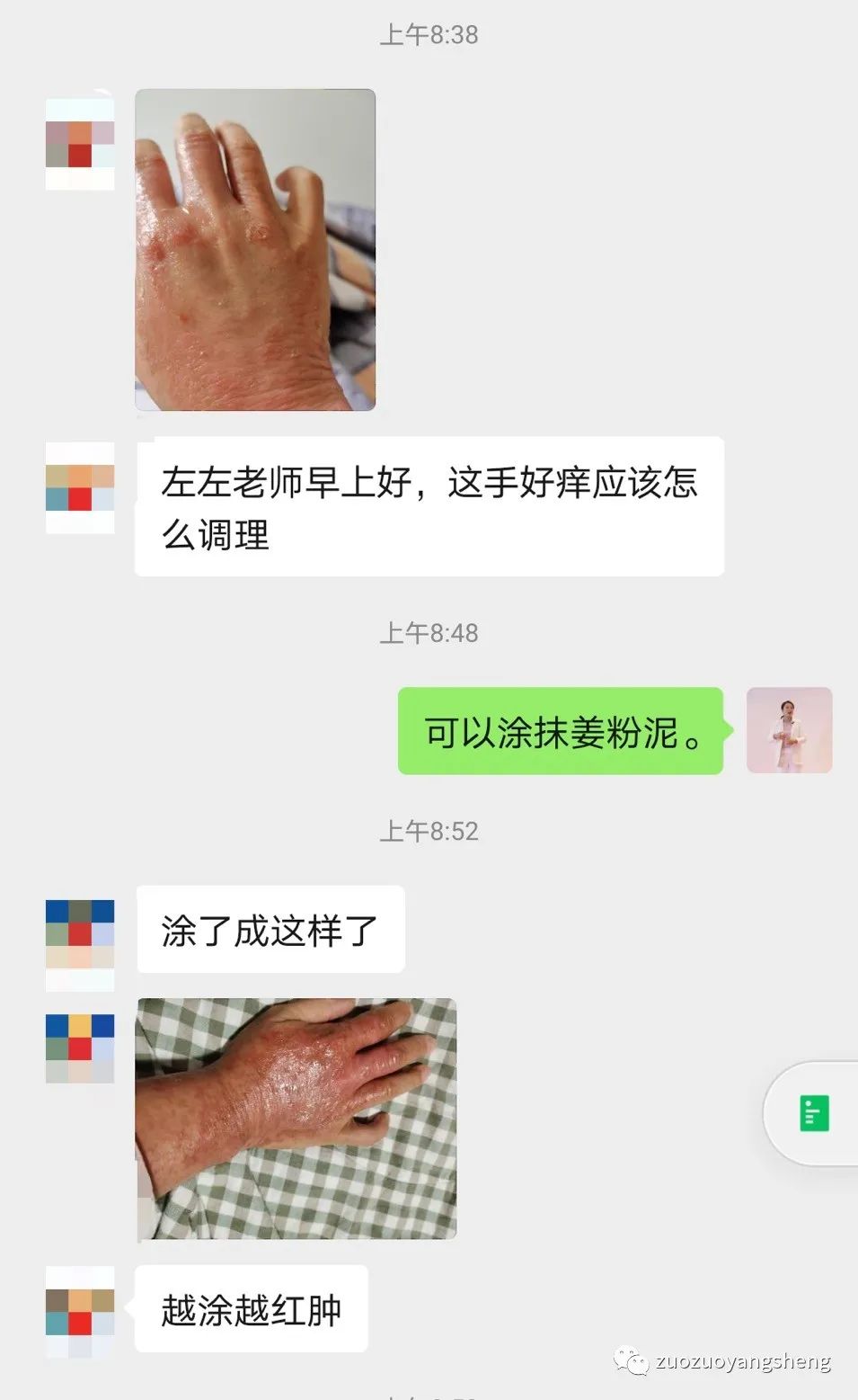 微问答191期:子宫内膜增厚,温敷,喝姜汤后,月经23天还血流不止…… 微问答191期:子宫内膜增厚,温敷,喝姜汤后,月经23天还血流不止……