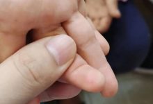 案例分享:原始点调理小孩手足口病的案例-原始点全球同学网