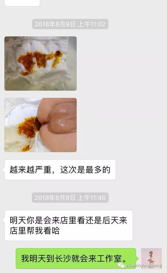 案例分享:原始点调理三个月宝宝腹泻、便血的案例 案例分享:原始点调理三个月宝宝腹泻、便血的案例