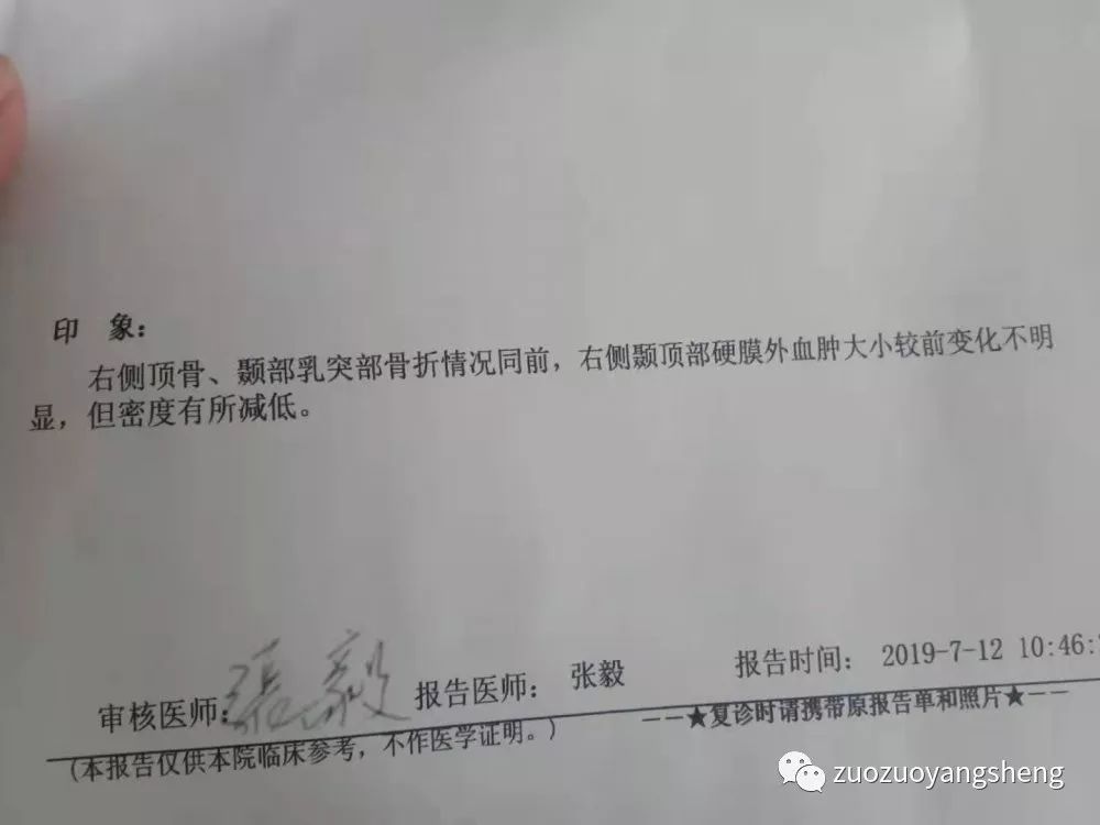 原始点调理因车祸出现的面瘫案例 原始点调理因车祸出现的面瘫案例